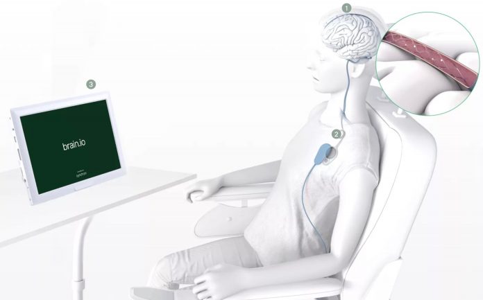 fda-approved-brain-computer-interface-company-“synchron”-implants-first-brain-device-in-united-states-patient