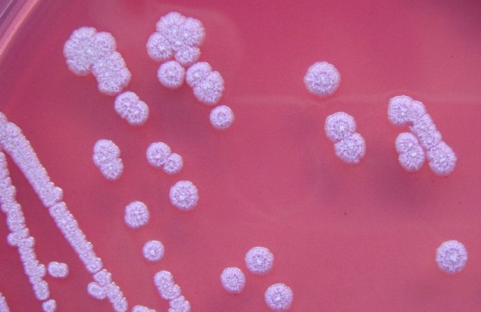 cdc-warns-of-a-bacteria-that-causes-rare-and-serious-disease-discovered-in-us.-for-1st-time-in-environmental-samples