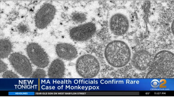 professionals:-monkeypox-spread-by-gay-sex-between-men-…-so-how-did-those-children,-dogs-and-2-yr-old-get-monkeypox?