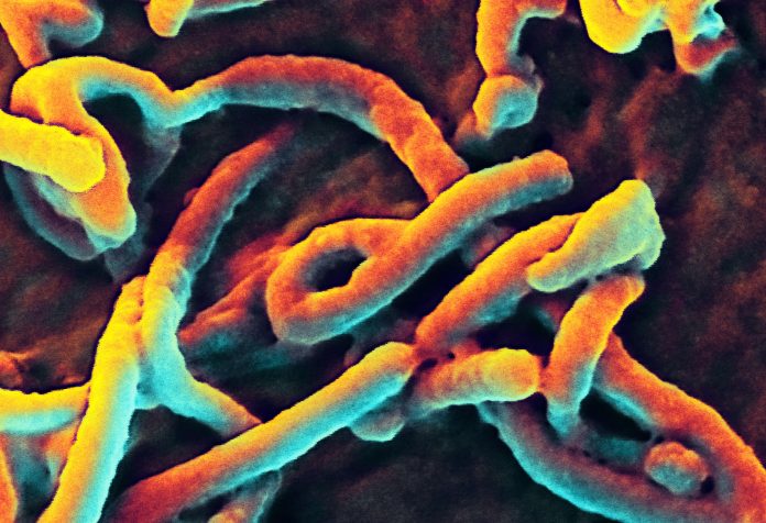 here-we-go:-ebola-outbreak-in-uganda-has-doctors-scrambling