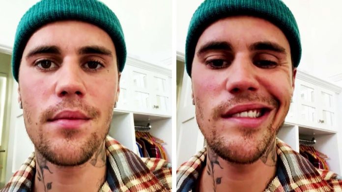 justin-bieber-cancels-2023-tour-dates-because-of-persistent-face-paralysis-issue