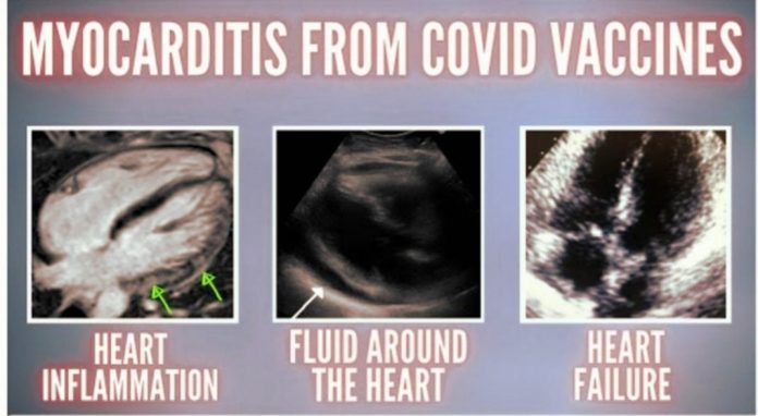 dripped-report-confirms-myocarditis-cases-spiked-in-united-states-military-following-forced-covid-shots–-as-gateway-pundit-has-been-reporting-now-for-over-2-years