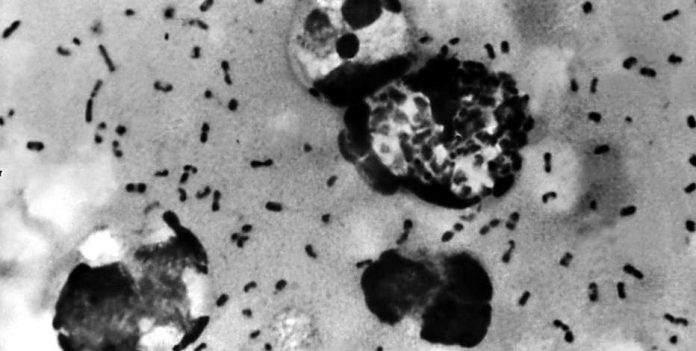 public-health-officials-warn-of-human-plague-case-in-colorado