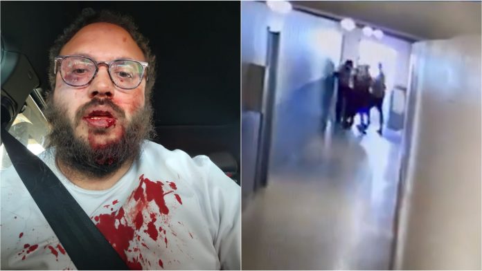 shock-video:-aurora-apartment-worker-beaten-bloody-by-venezuelan-tren-de-aragua-gang-members